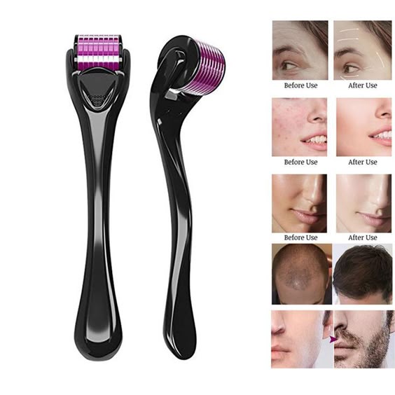 Derma roller system
